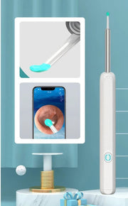 Earwax Removal Kit – Smart Visual Earwax Removal Tool