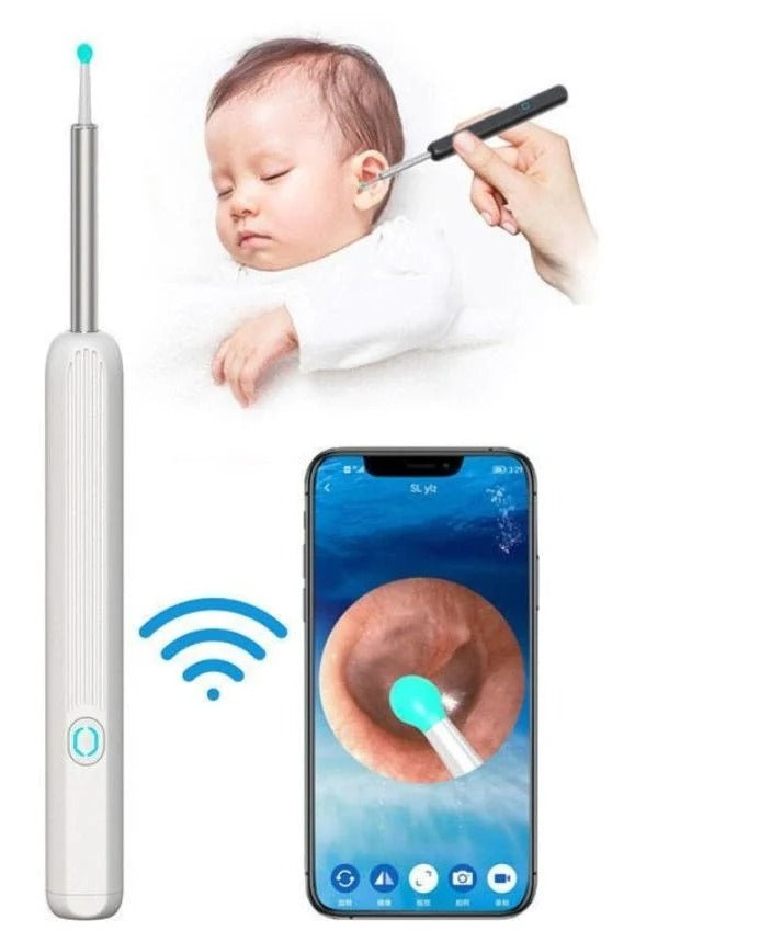 Earwax Removal Kit – Smart Visual Earwax Removal Tool