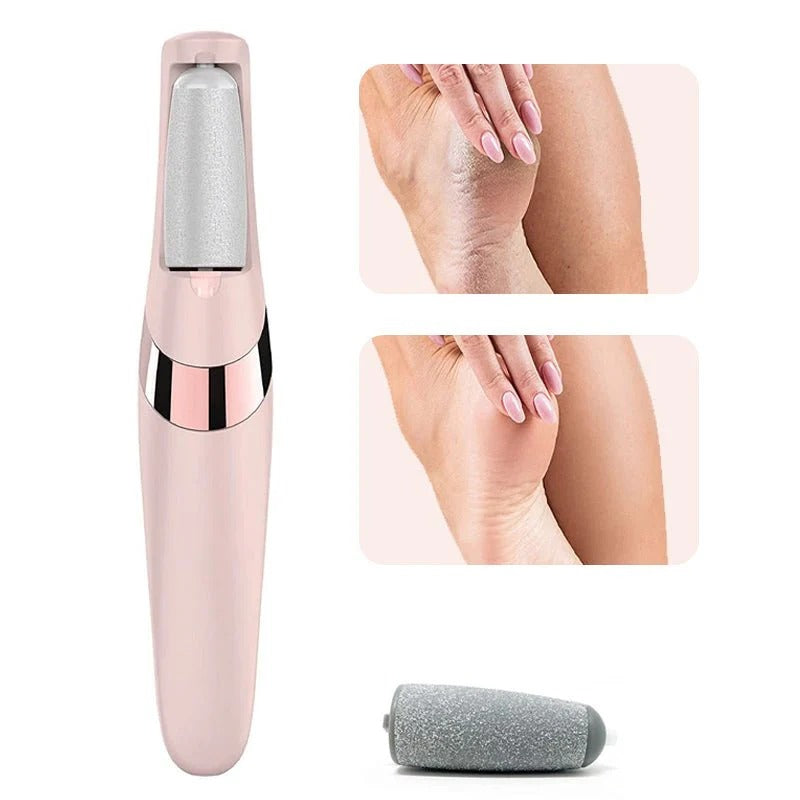 Electric Callus Remover – Rechargeable 2-Speed Foot File
