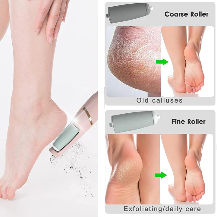Electric Callus Remover – Rechargeable 2-Speed Foot File