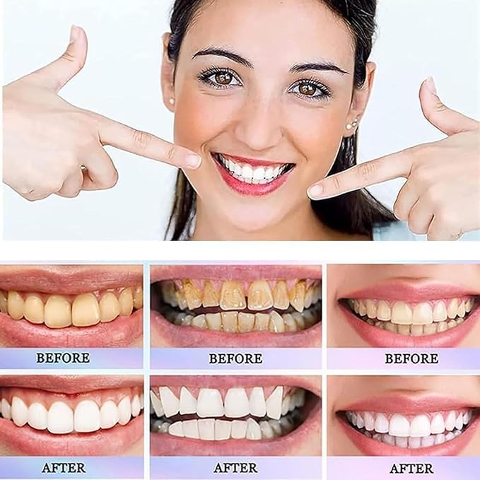 Nicotinamide Dazzle White Toothpaste
