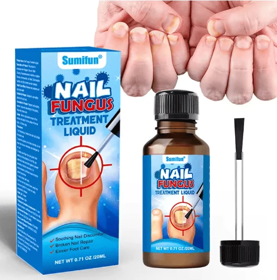 Nail Fungus Treatment Liquid -(20ml)