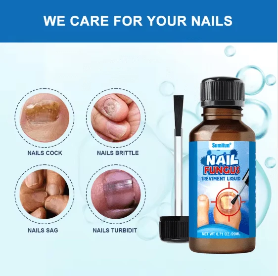 Nail Fungus Treatment Liquid -(20ml)